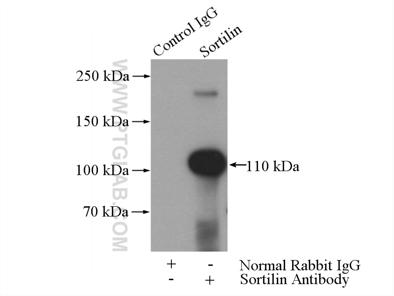 IP experiment of rat brain using 12369-1-AP (same clone as 12369-1-PBS)
