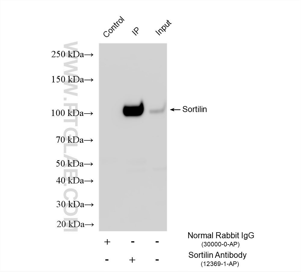 IP experiment of mouse brain using 12369-1-AP IP experiment of mouse brain using 12369-1-AP
