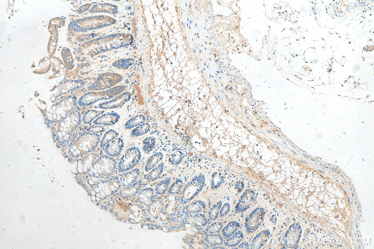 IHC staining of mouse colon using 55041-1-AP