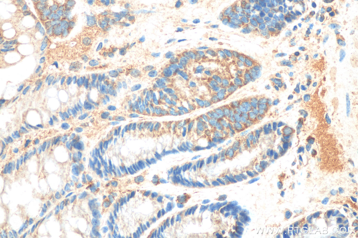 IHC staining of mouse colon using 55041-1-AP