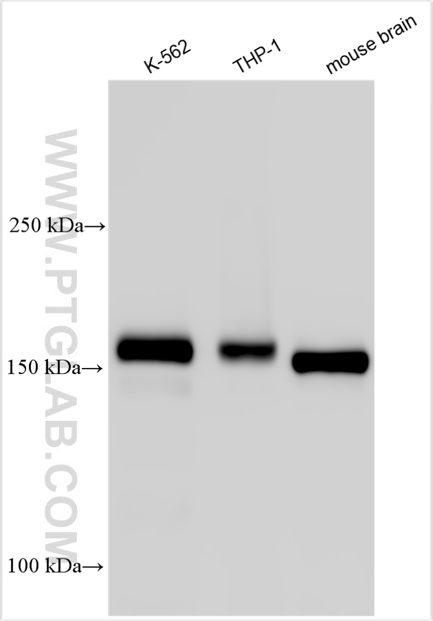 WB analysis using 55041-1-AP