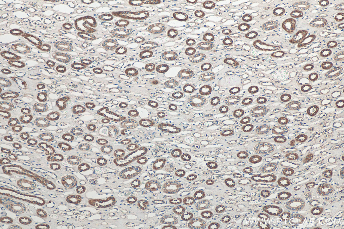 IHC staining of human kidney using 21933-1-AP