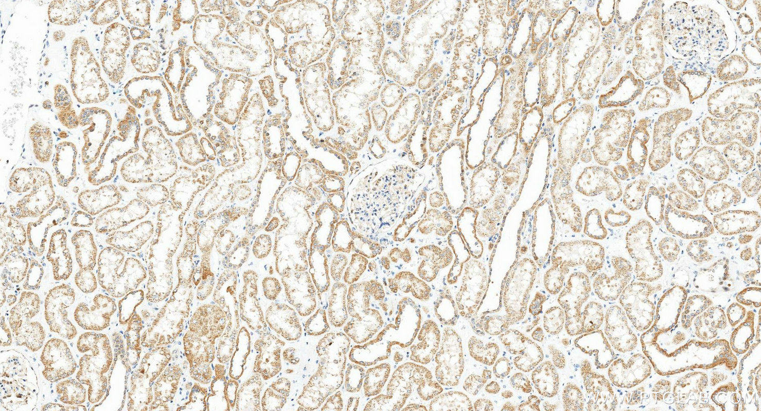 IHC staining of human kidney using 21933-1-AP IHC staining of human kidney using 21933-1-AP