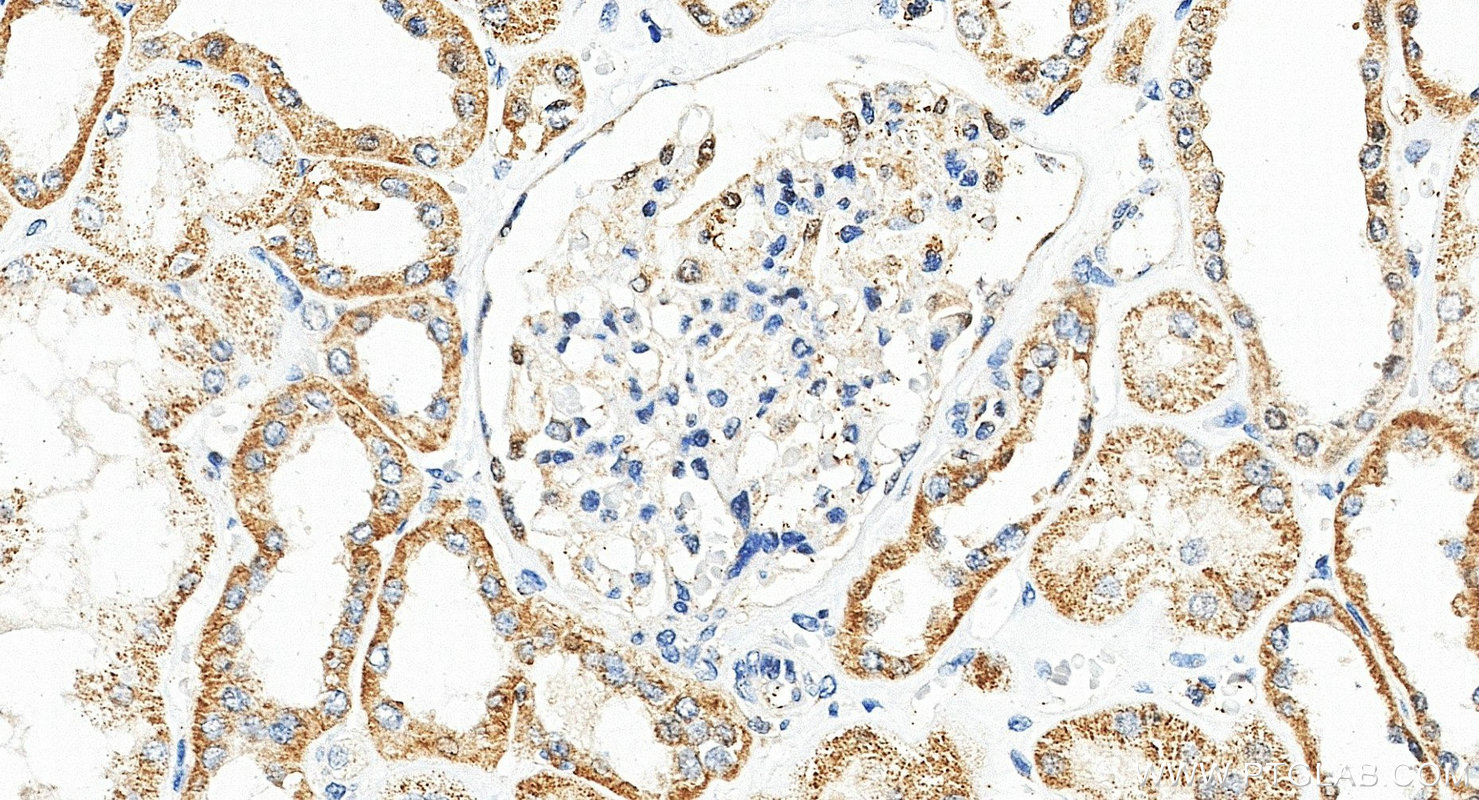 IHC staining of human kidney using 21933-1-AP IHC staining of human kidney using 21933-1-AP