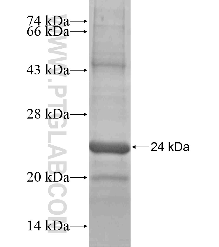 SOSTDC1 fusion protein Ag17667 SDS-PAGE SOSTDC1 fusion protein Ag17667 SDS-PAGE