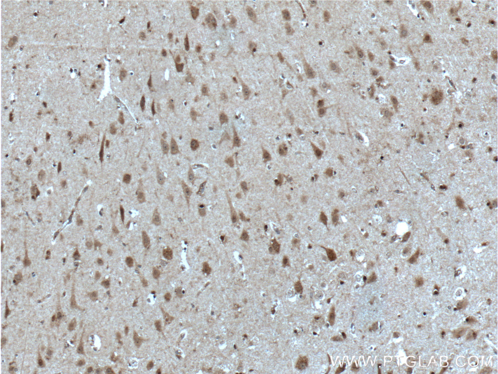 IHC staining of human brain using 10422-1-AP