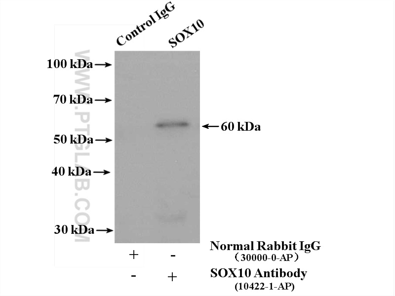 IP experiment of mouse colon using 10422-1-AP