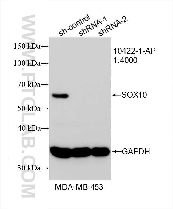 WB analysis of MDA-MB-453 using 10422-1-AP (same clone as 10422-1-PBS)