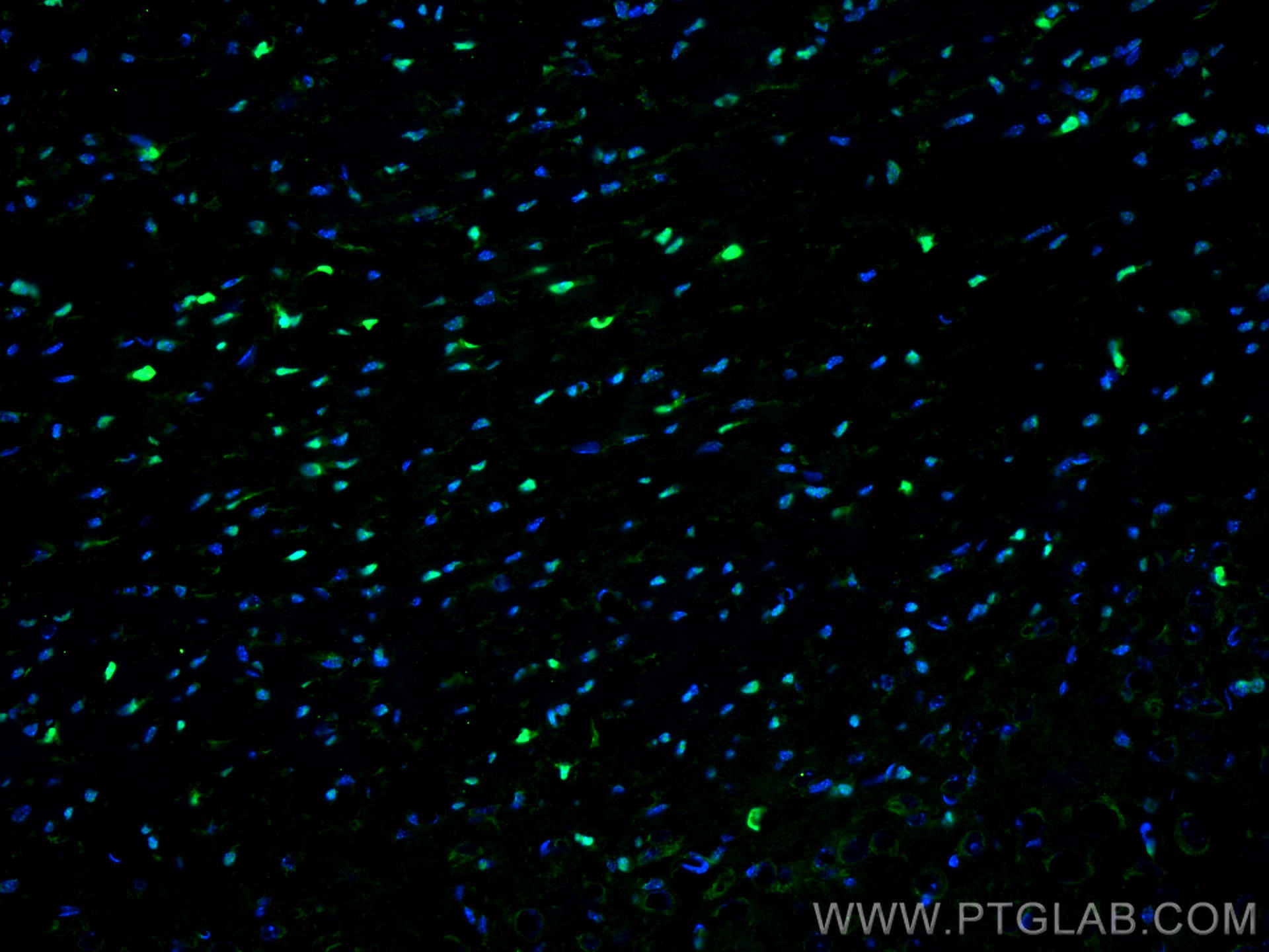 IF Staining of mouse brain using 66786-1-Ig