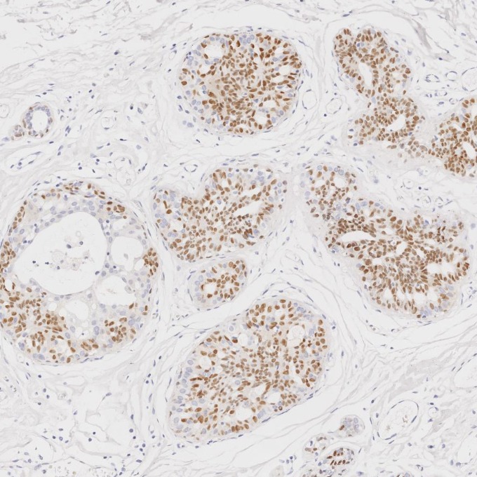 IHC staining of human breast using 66786-1-Ig IHC staining of human breast using 66786-1-Ig