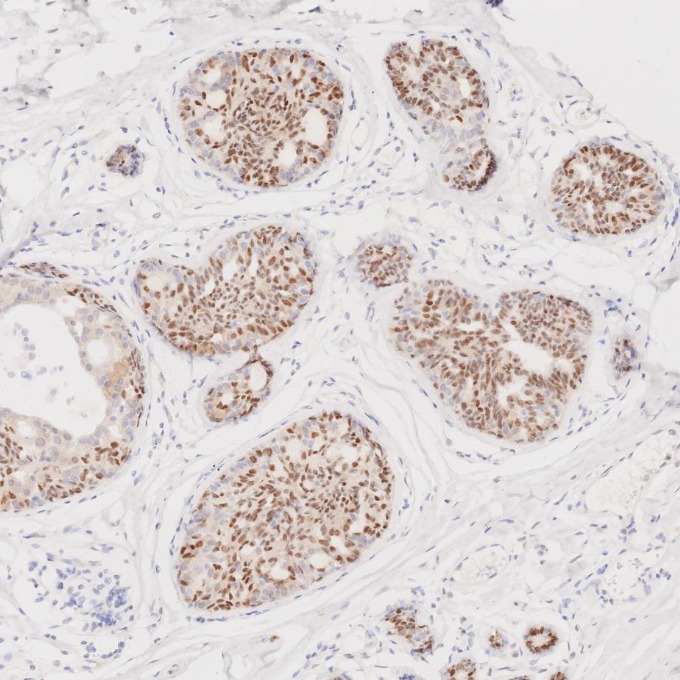 IHC staining of human breast using 66786-1-Ig IHC staining of human breast using 66786-1-Ig