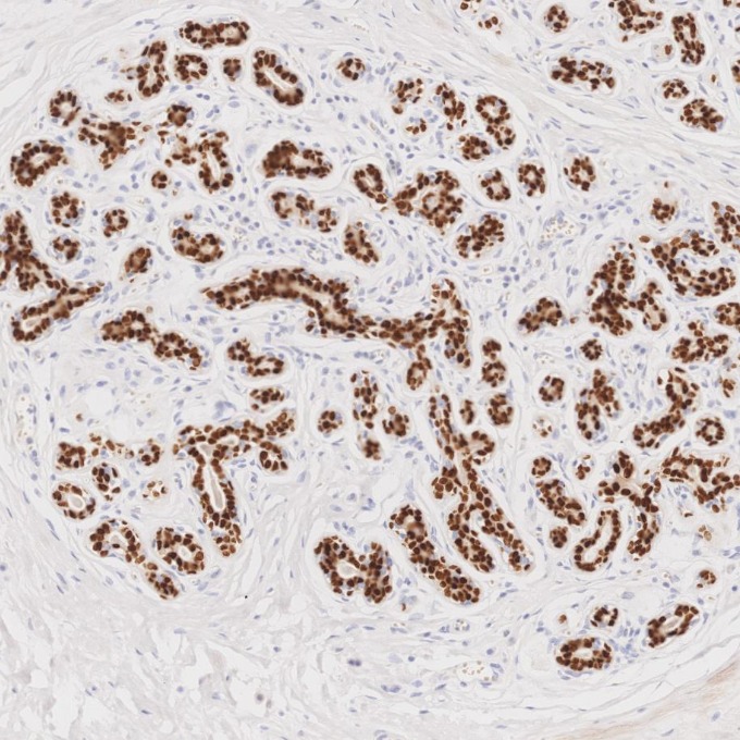 IHC staining of human breast using 87051-3-RR (same clone as 87051-3-PBS)