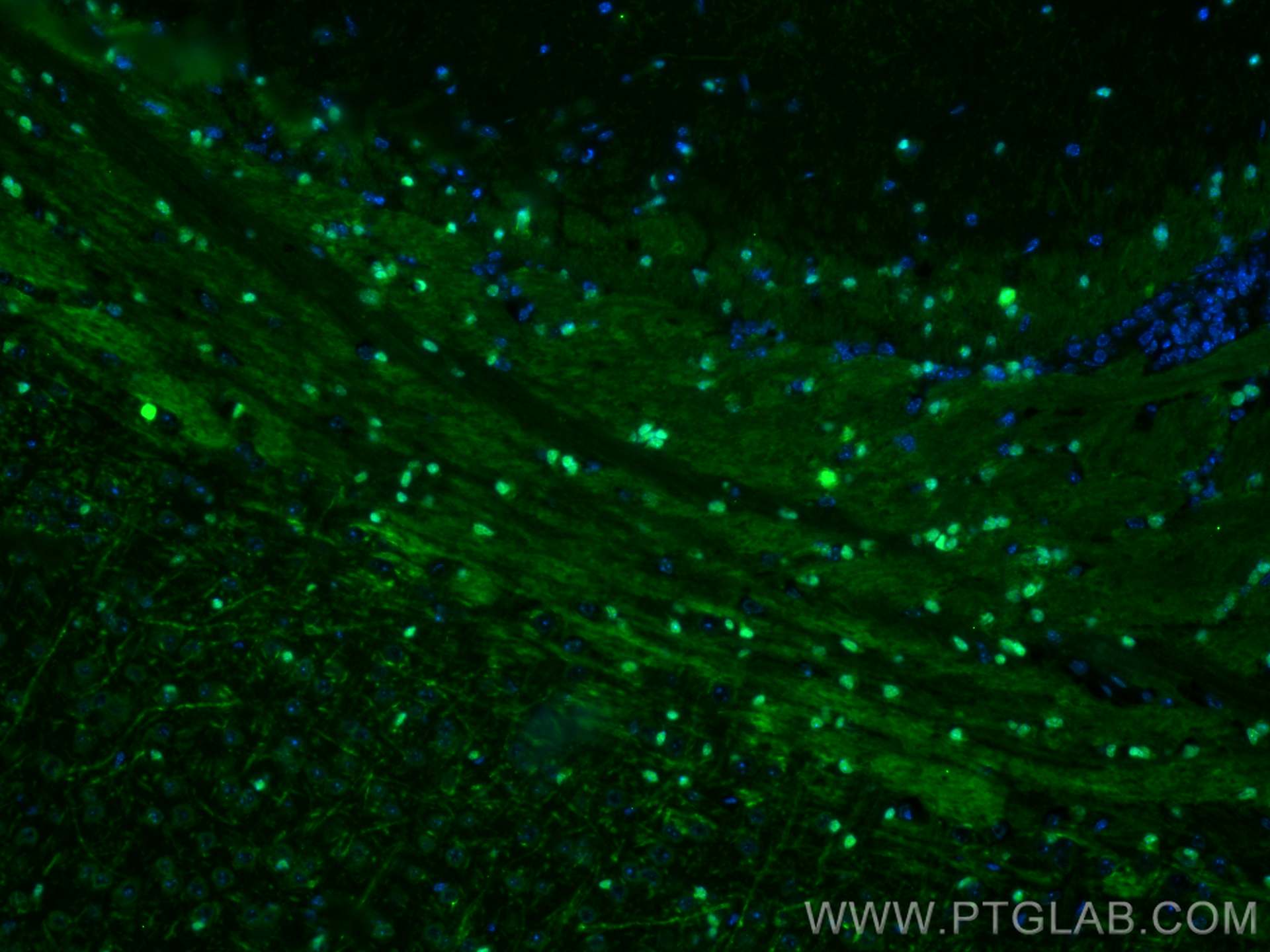 IF Staining of mouse brain using CL488-66786