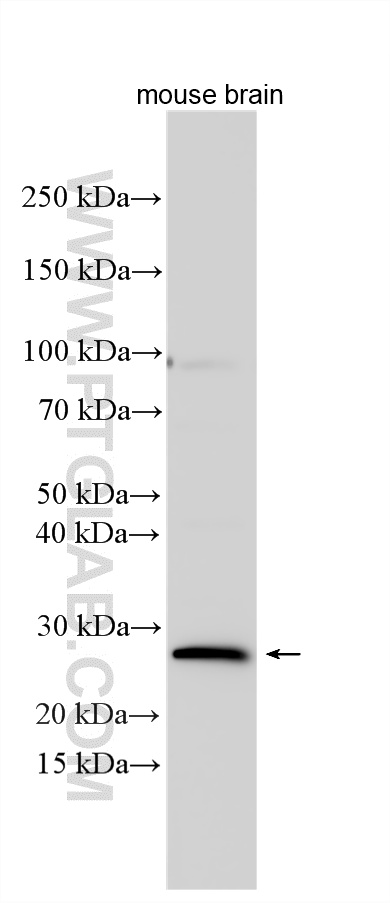WB analysis using 30613-1-AP (same clone as 30613-1-PBS) WB analysis using 30613-1-AP (same clone as 30613-1-PBS)
