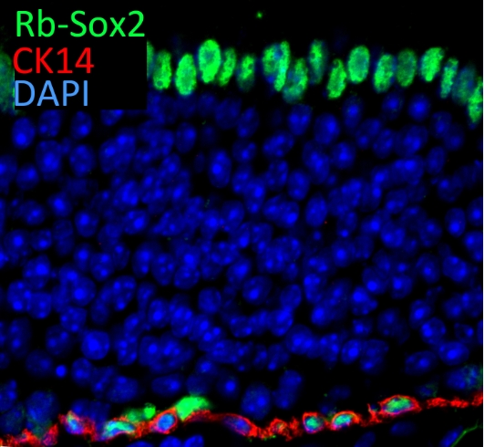 SOX2 Polyclonal antibody