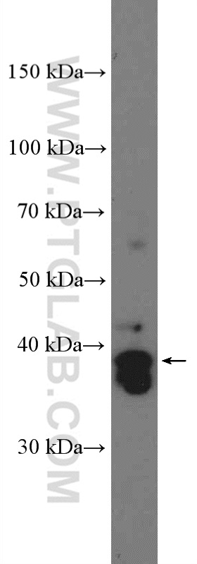 WB analysis of HEK-293 using 11064-1-AP