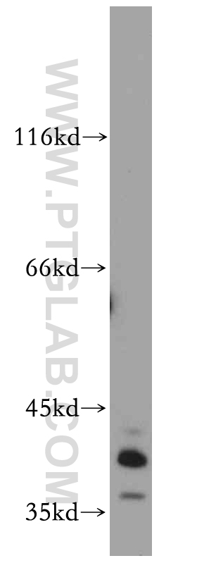 WB analysis of mouse brain using 20118-1-AP