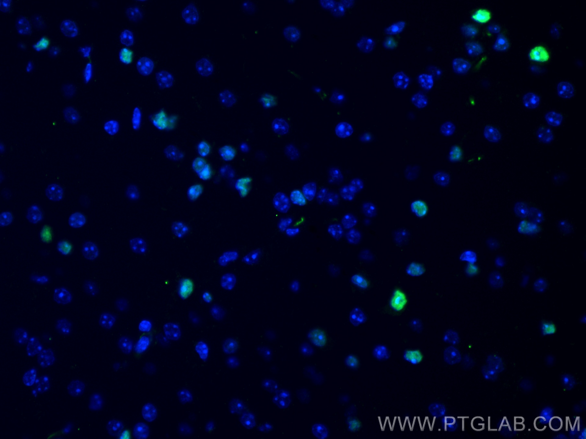 IF Staining of mouse brain using 66411-1-Ig