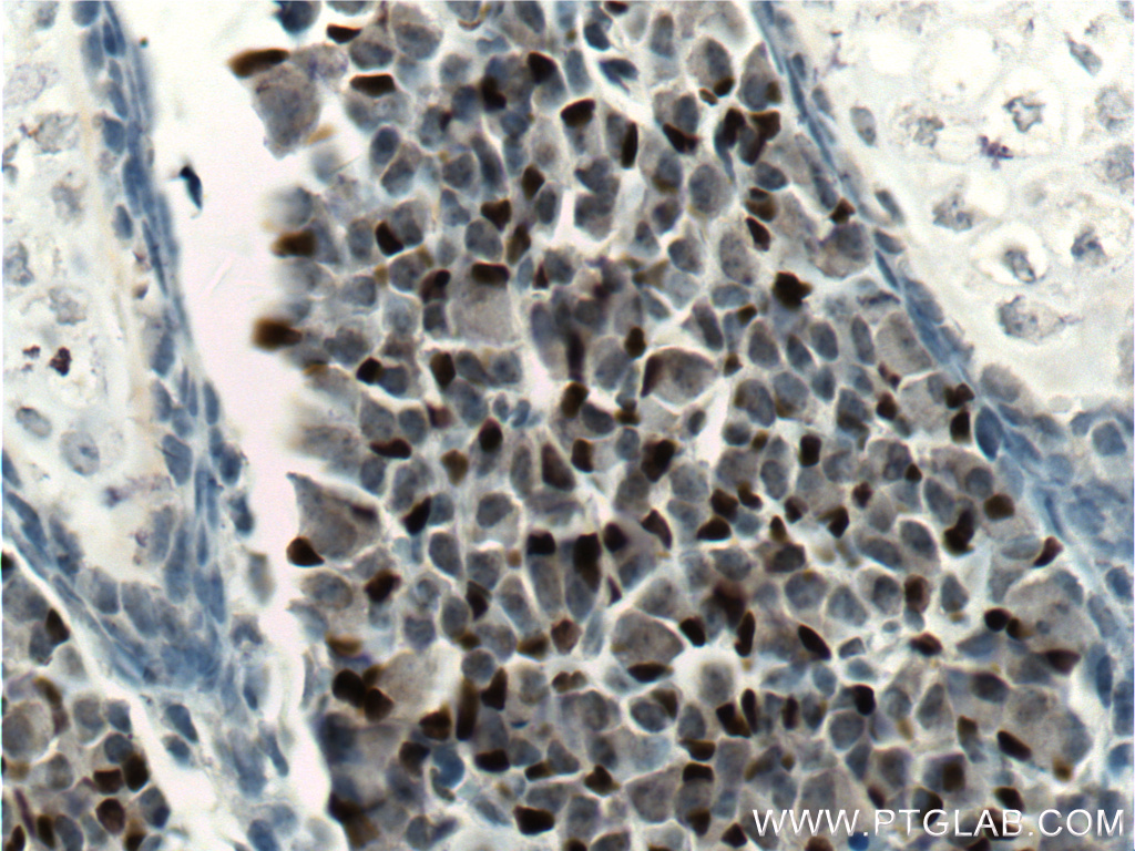 IHC staining of mouse embryo using 66411-1-Ig