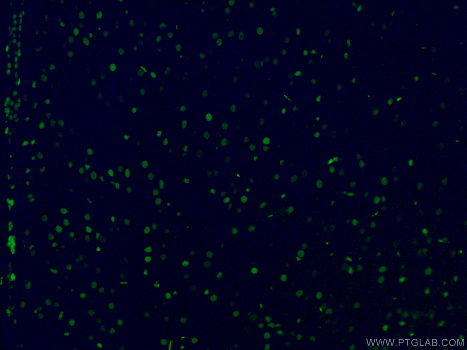 IF Staining of mouse brain using CL488-66411