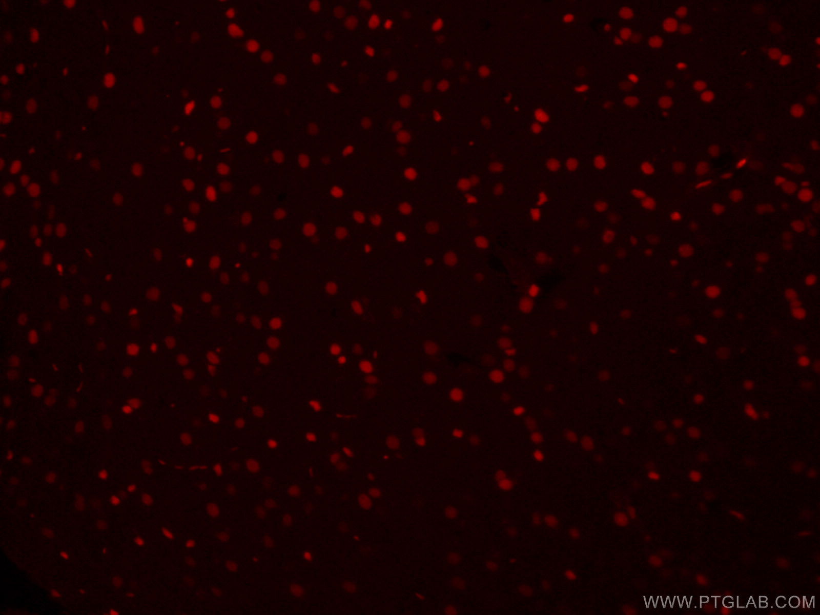 IF Staining of mouse brain using CL594-66411