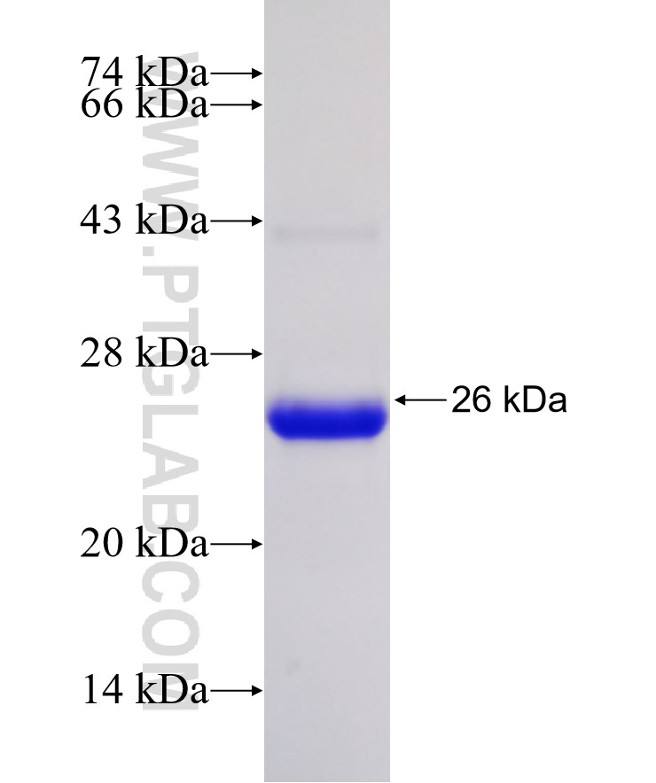 SOX30 fusion protein Ag31172 SDS-PAGE SOX30 fusion protein Ag31172 SDS-PAGE