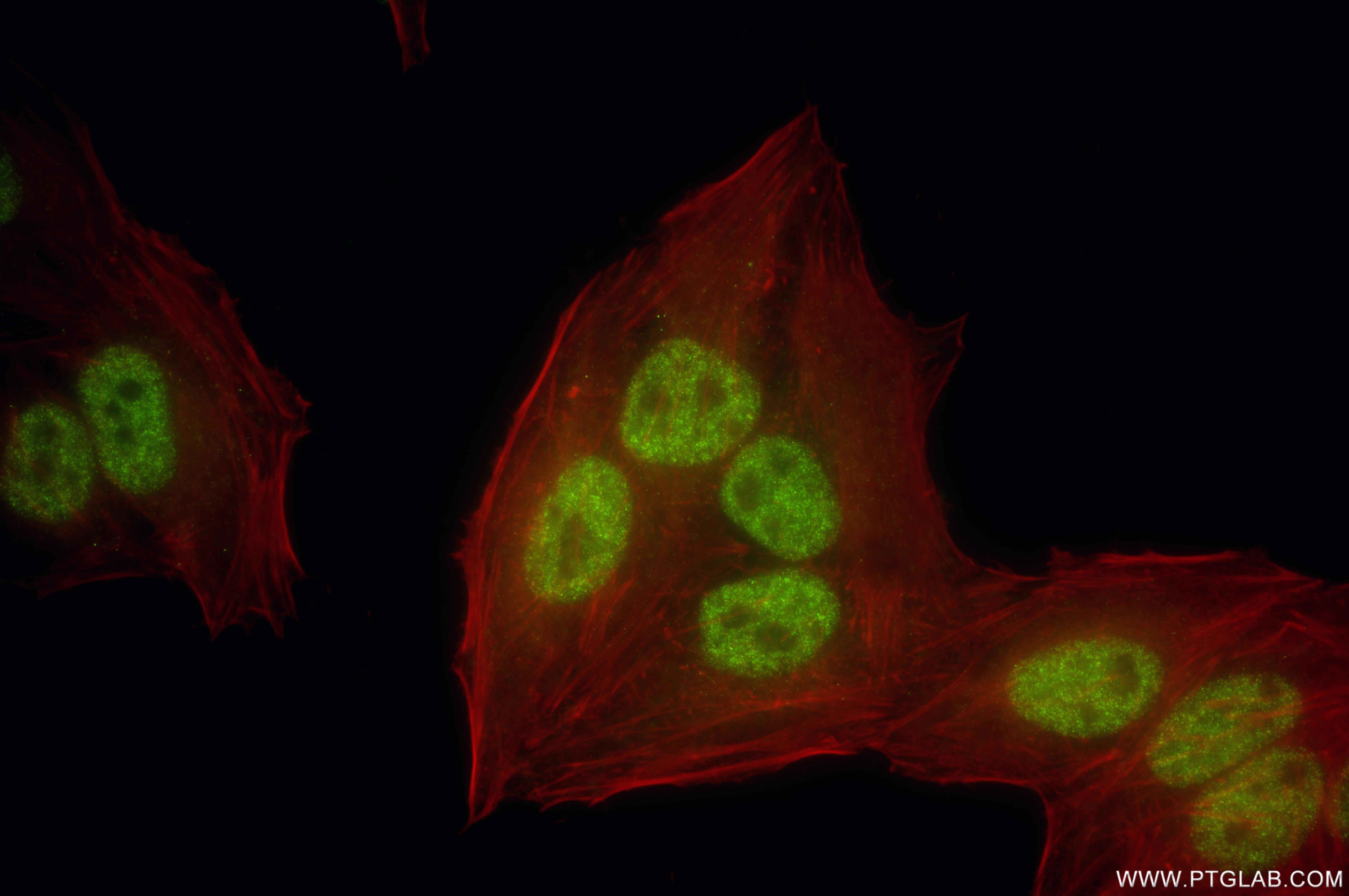IF Staining of HepG2 using 86619-2-RR (same clone as 86619-2-PBS) IF Staining of HepG2 using 86619-2-RR (same clone as 86619-2-PBS)