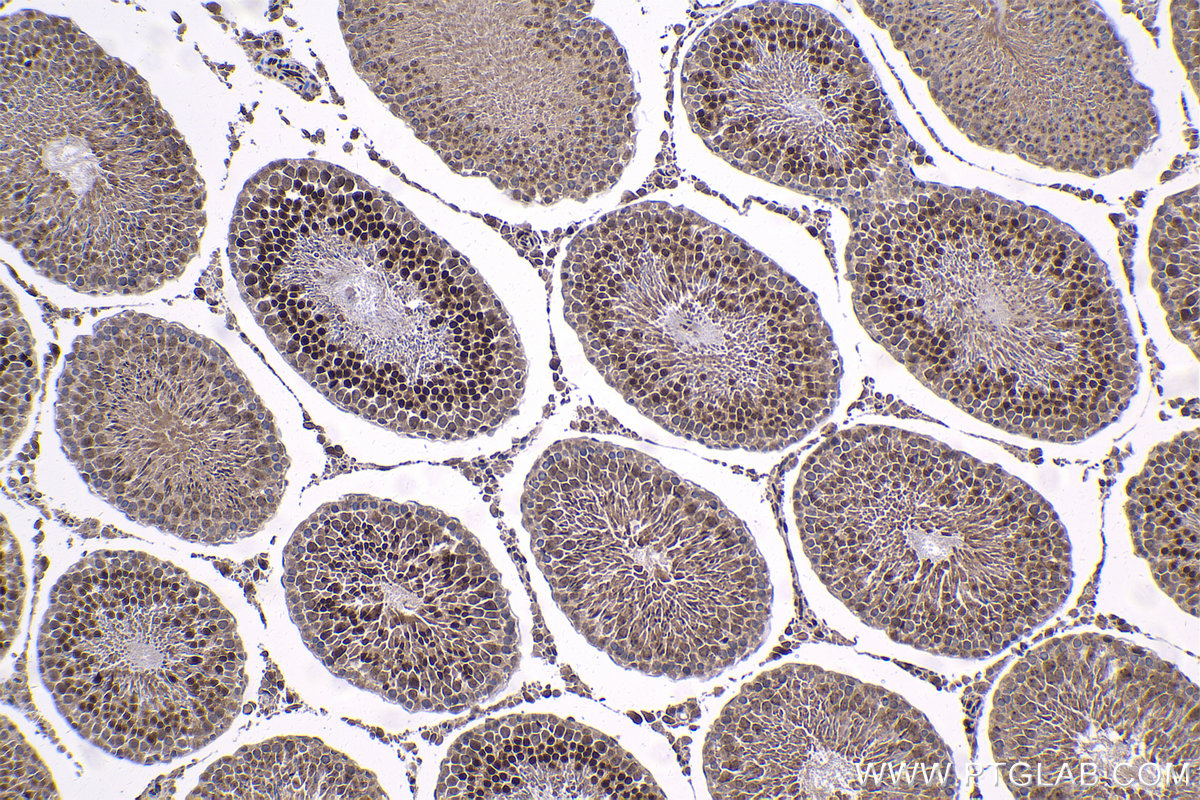 IHC staining of rat testis using 14010-1-AP