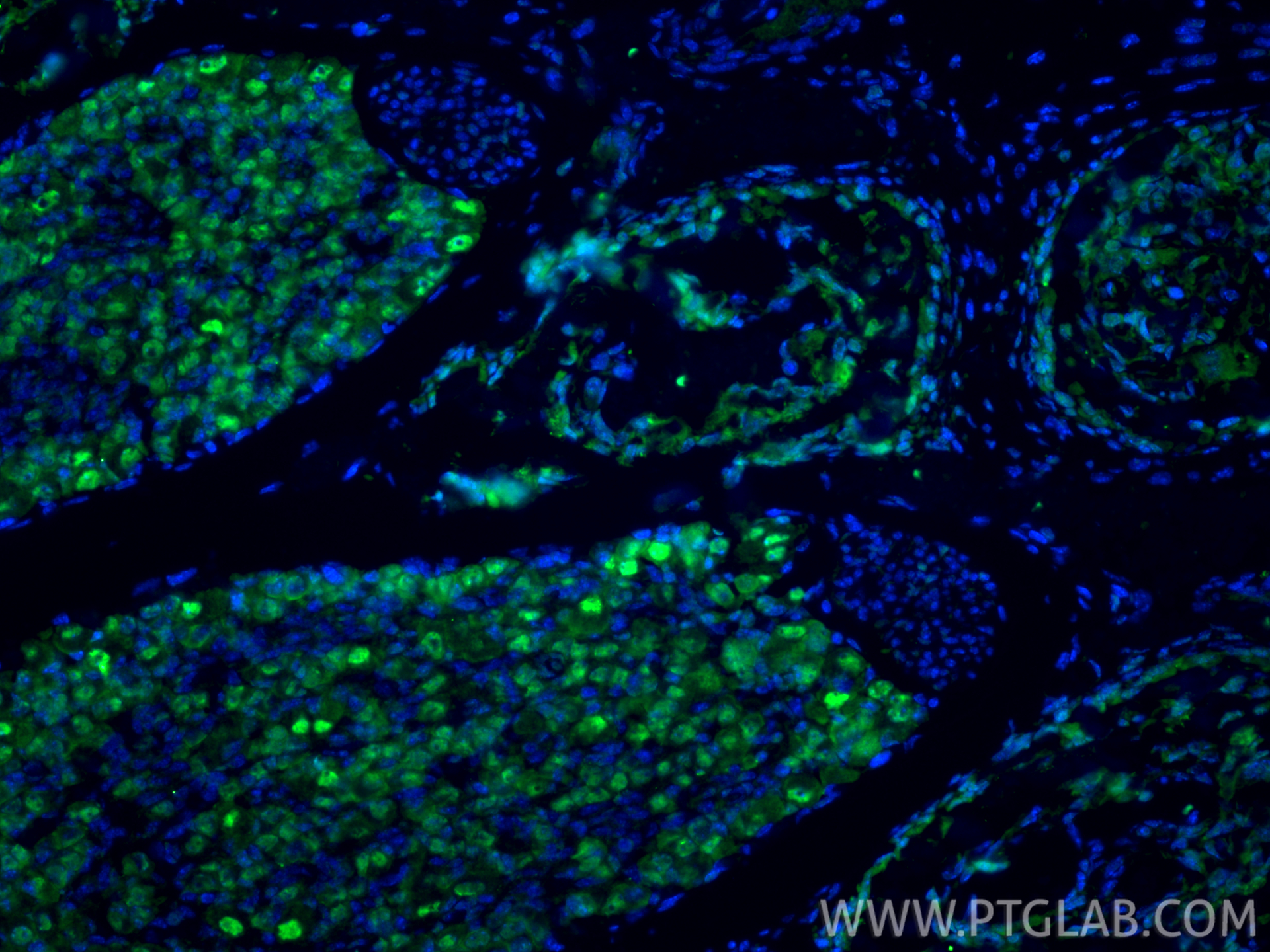 IF Staining of mouse embryo using 55152-1-AP IF Staining of mouse embryo using 55152-1-AP