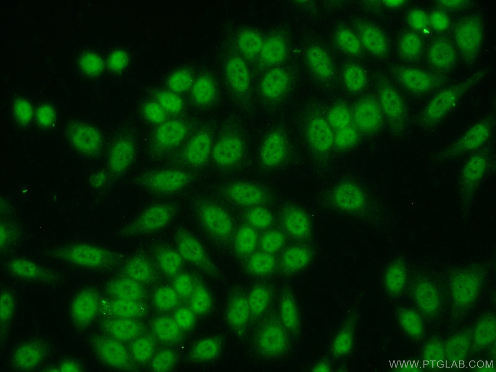 SP1 Polyclonal antibody