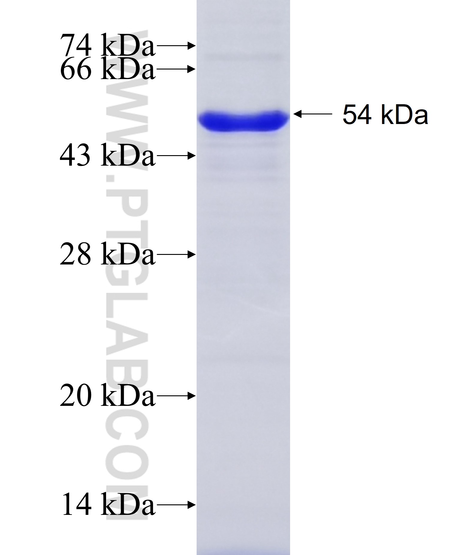 SP100 fusion protein Ag28524 SDS-PAGE