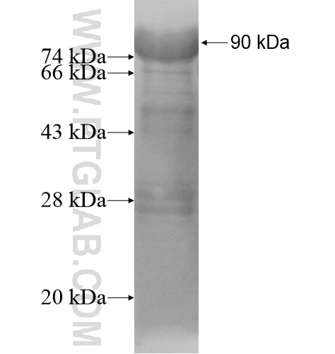 SP140 fusion protein Ag15887 SDS-PAGE SP140 fusion protein Ag15887 SDS-PAGE