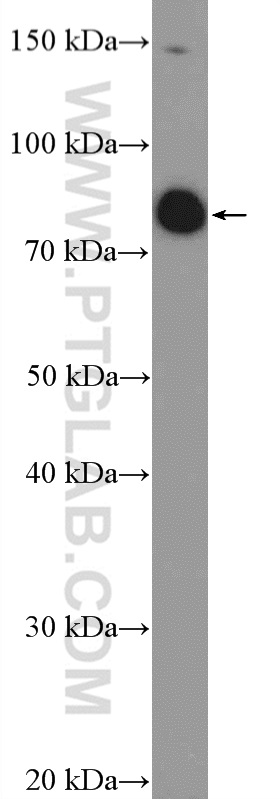 WB analysis of HeLa using 19845-1-AP