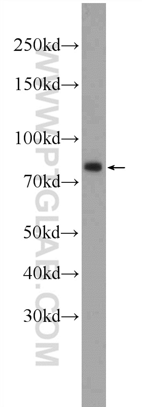 WB analysis of K-562 using 25000-1-AP