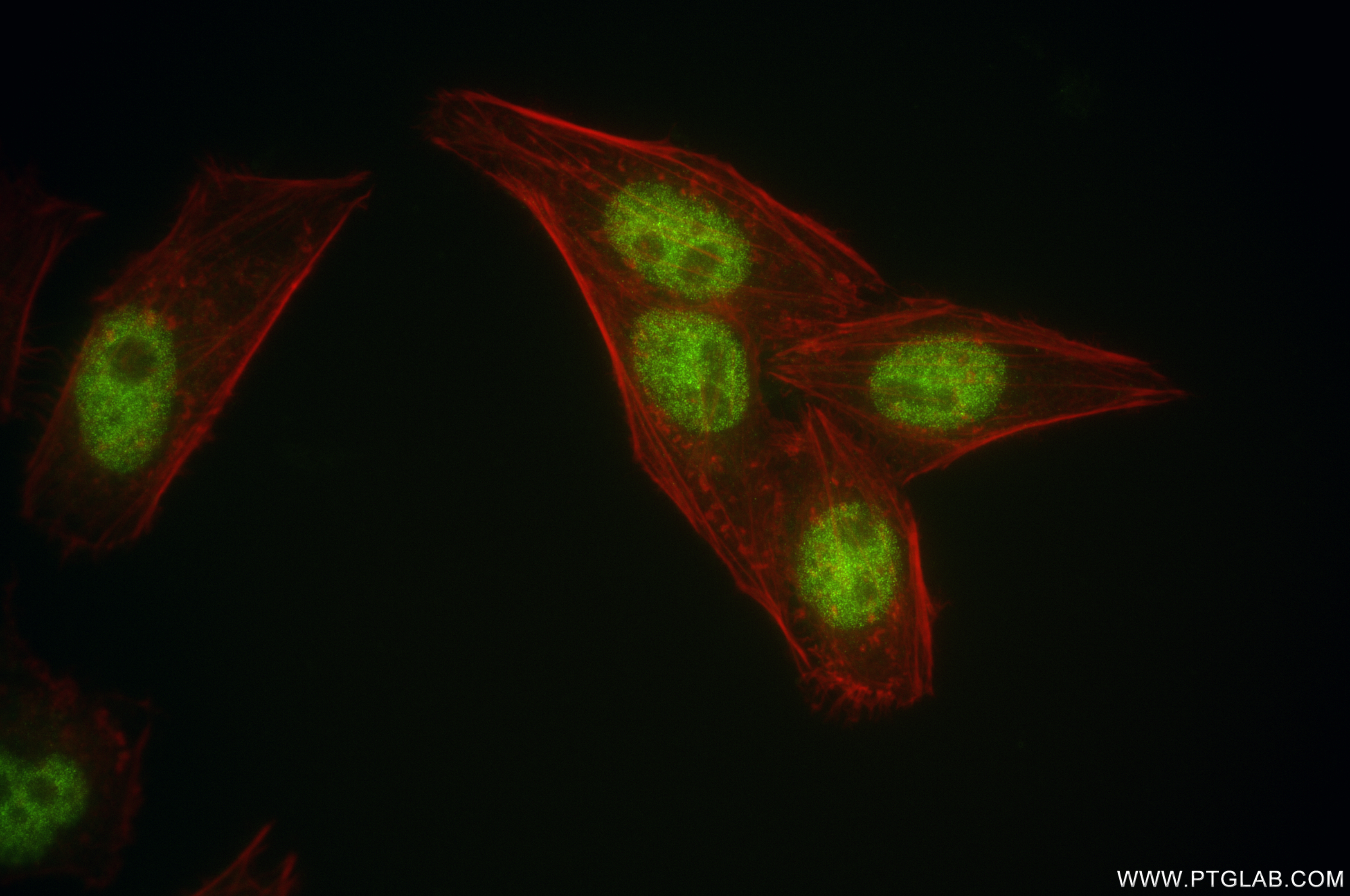 IF Staining of HepG2 using 85050-1-RR (same clone as 85050-1-PBS)