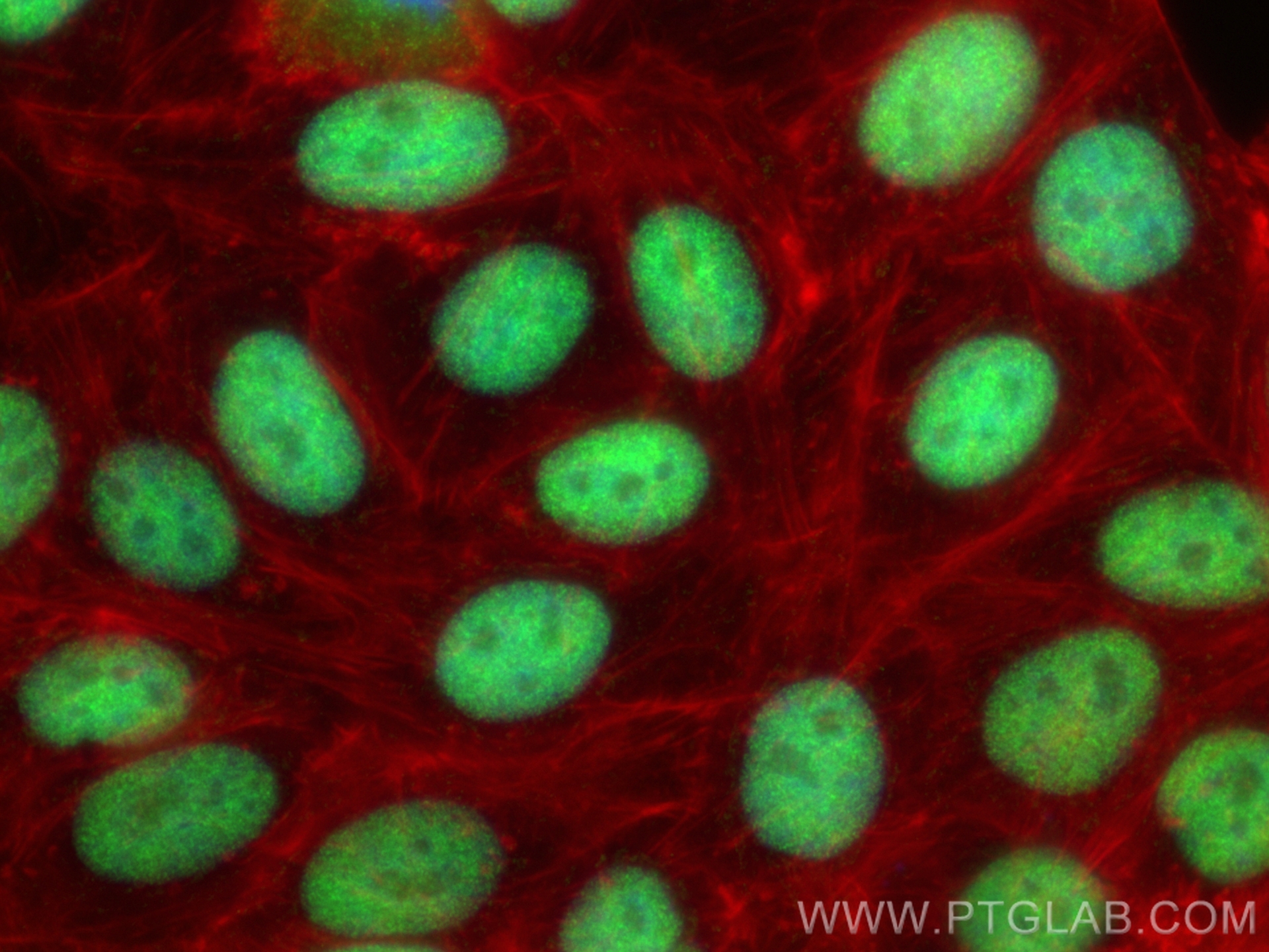 IF Staining of HepG2 using 85050-1-RR (same clone as 85050-1-PBS)