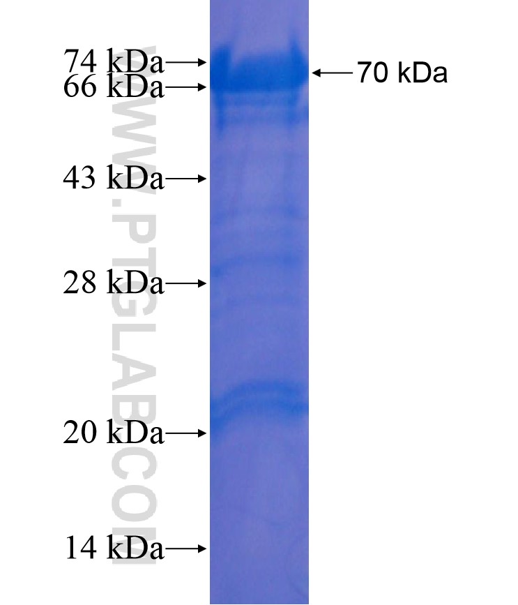 SP3 fusion protein Ag17800 SDS-PAGE SP3 fusion protein Ag17800 SDS-PAGE