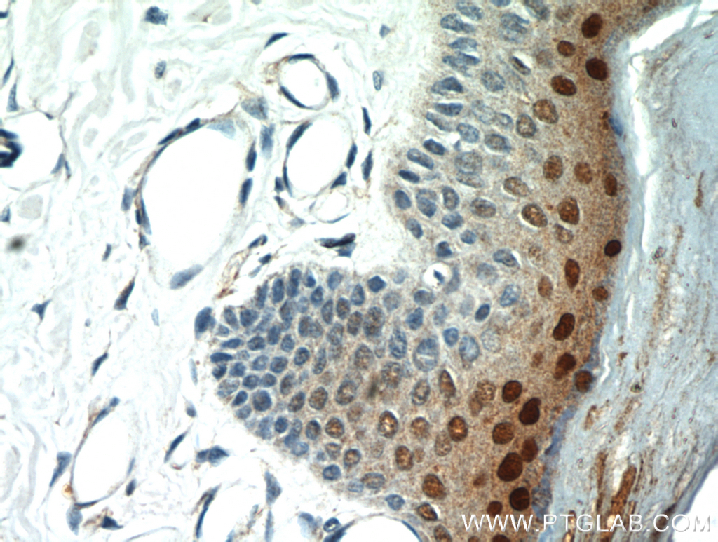 IHC staining of human skin using 21234-1-AP