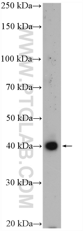 WB analysis of fetal human brain using 21234-1-AP