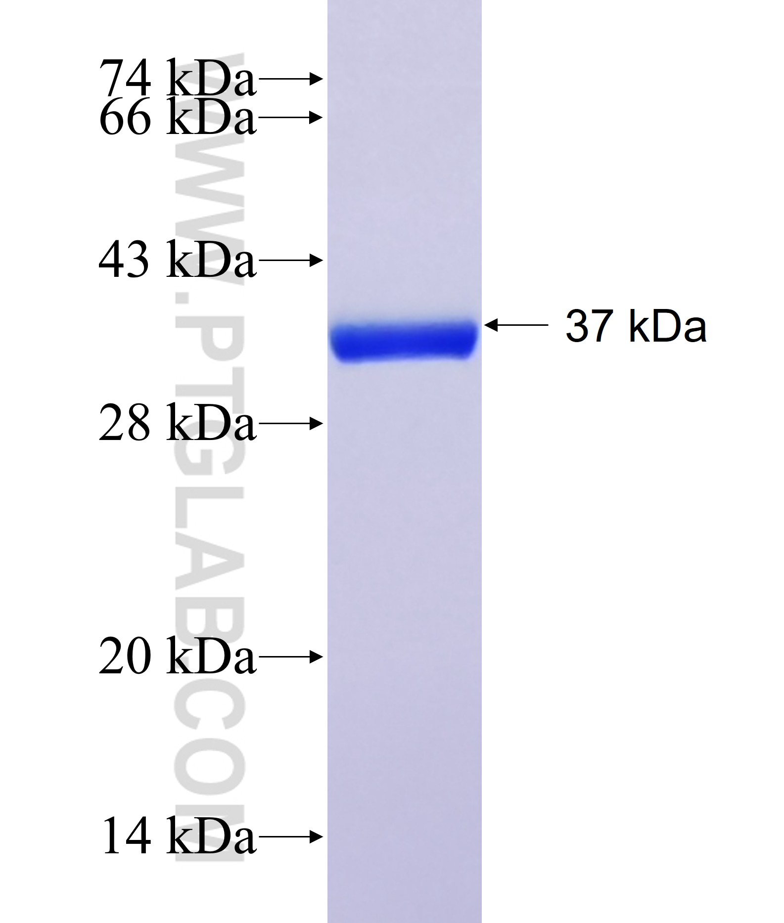 SP9 fusion protein Ag40950 SDS-PAGE SP9 fusion protein Ag40950 SDS-PAGE