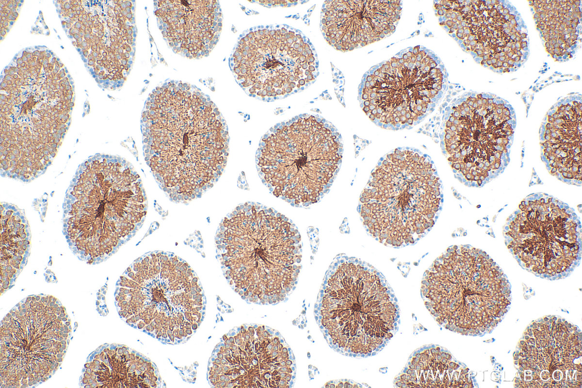 IHC staining of mouse testis using 13367-1-AP (same clone as 13367-1-PBS) IHC staining of mouse testis using 13367-1-AP (same clone as 13367-1-PBS)