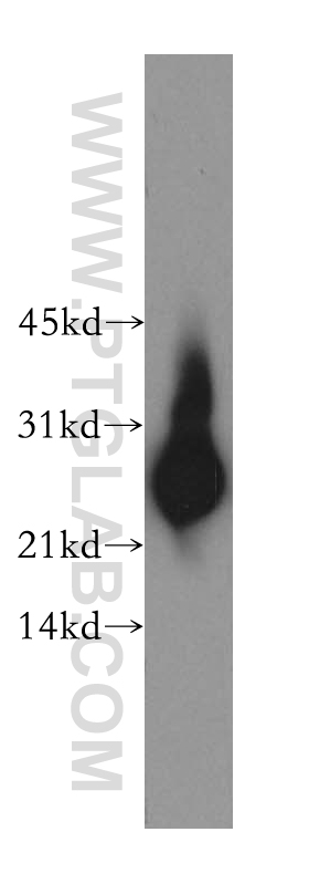 WB analysis of mouse testis using 13367-1-AP