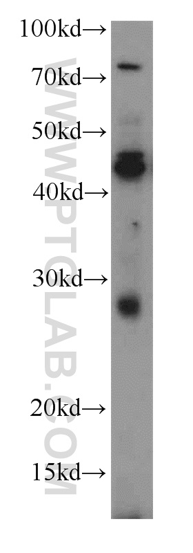 WB analysis of HEK-293 using 21137-1-AP