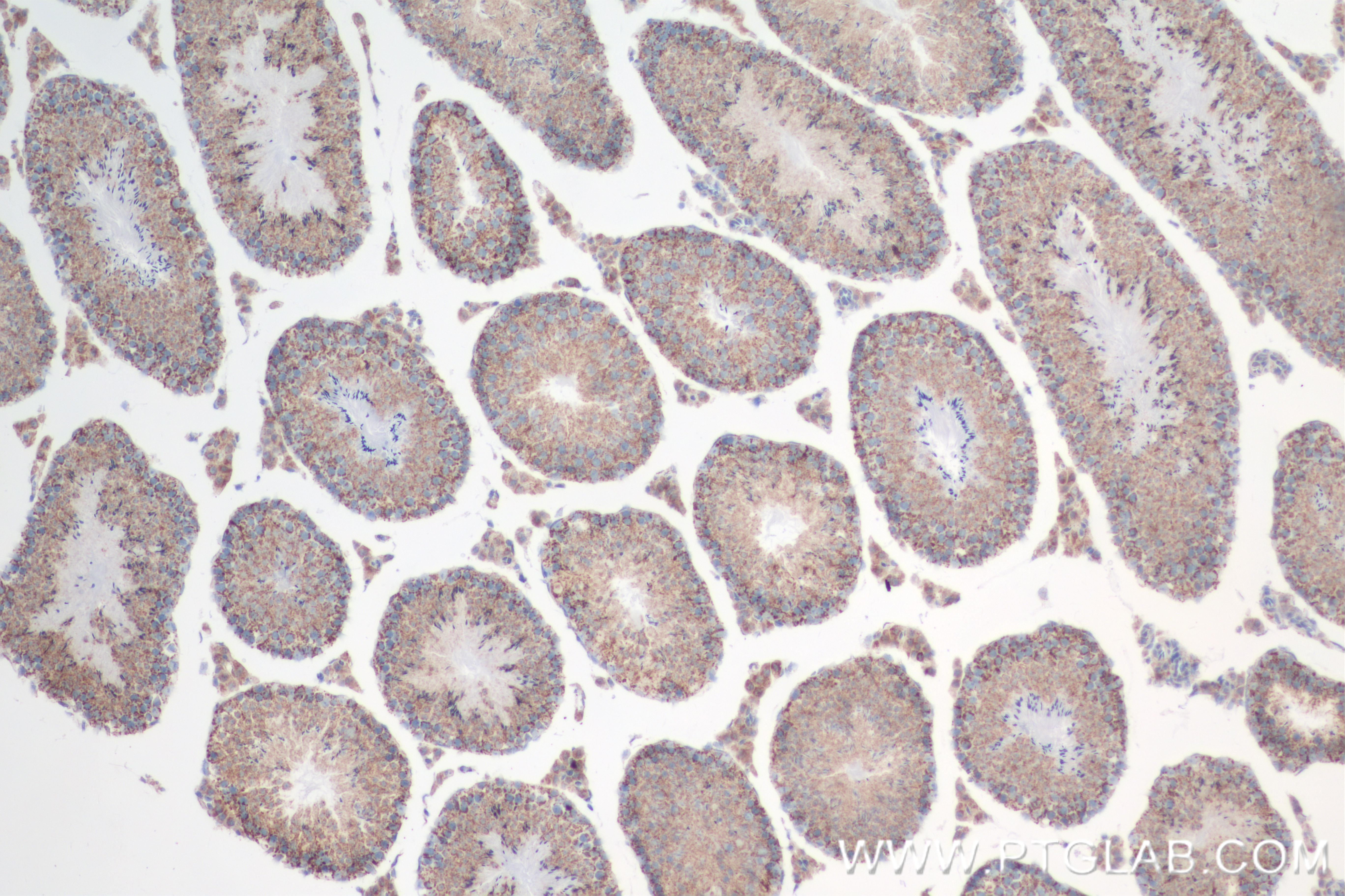 IHC staining of mouse testis using 84842-1-RR