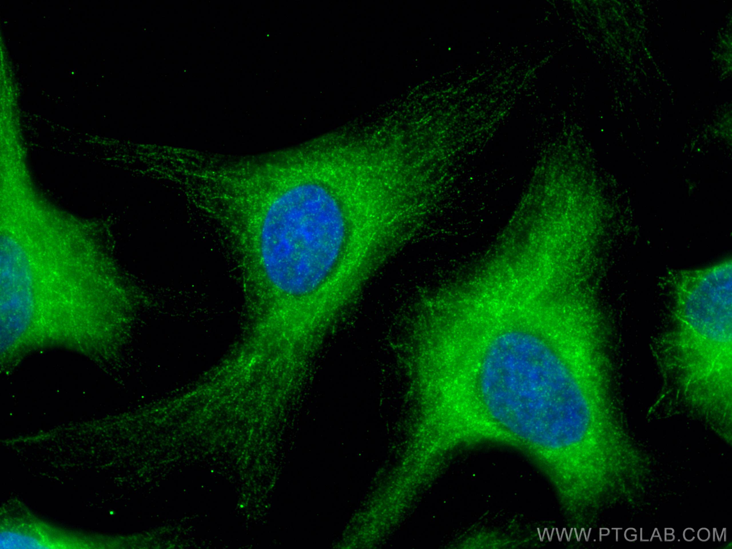 IF Staining of HeLa using 14726-1-AP