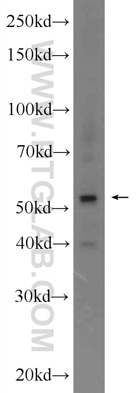 WB analysis of mouse testis using 12462-1-AP