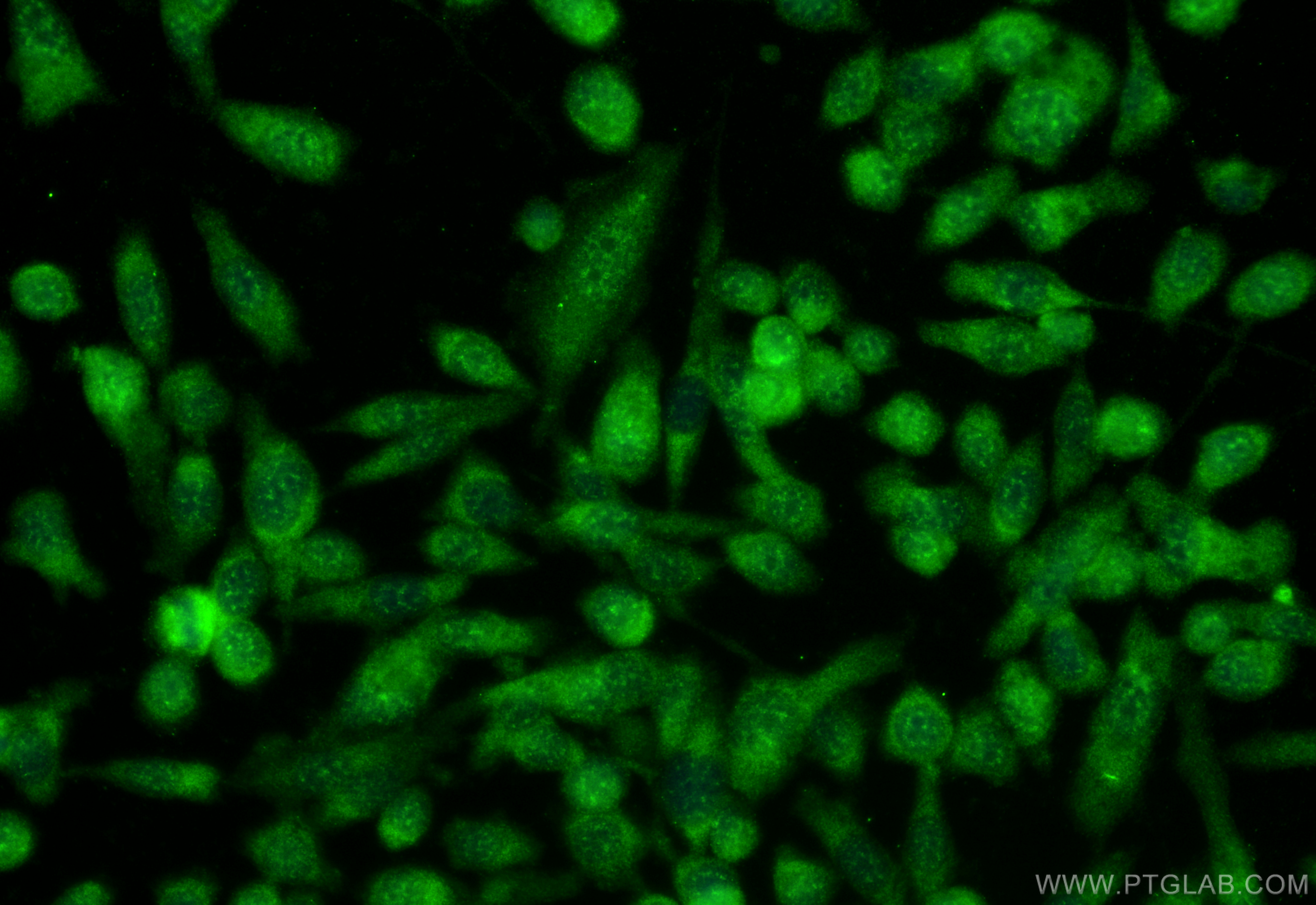 IF Staining of PC-3 using 13915-1-AP