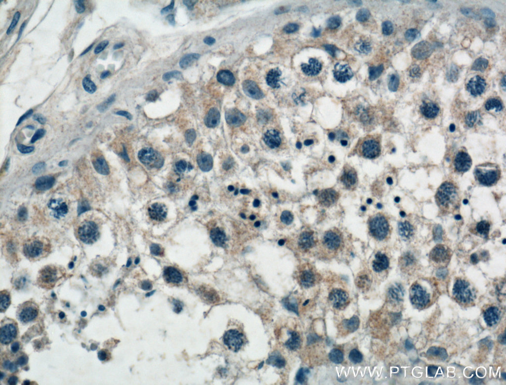 IHC staining of human testis using 24423-1-AP
