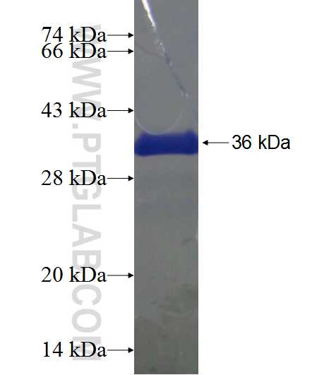 SPAG9 fusion protein Ag19763 SDS-PAGE