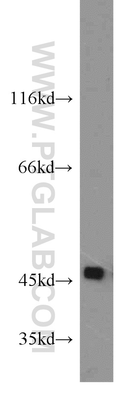 SPAM1 Polyclonal antibody